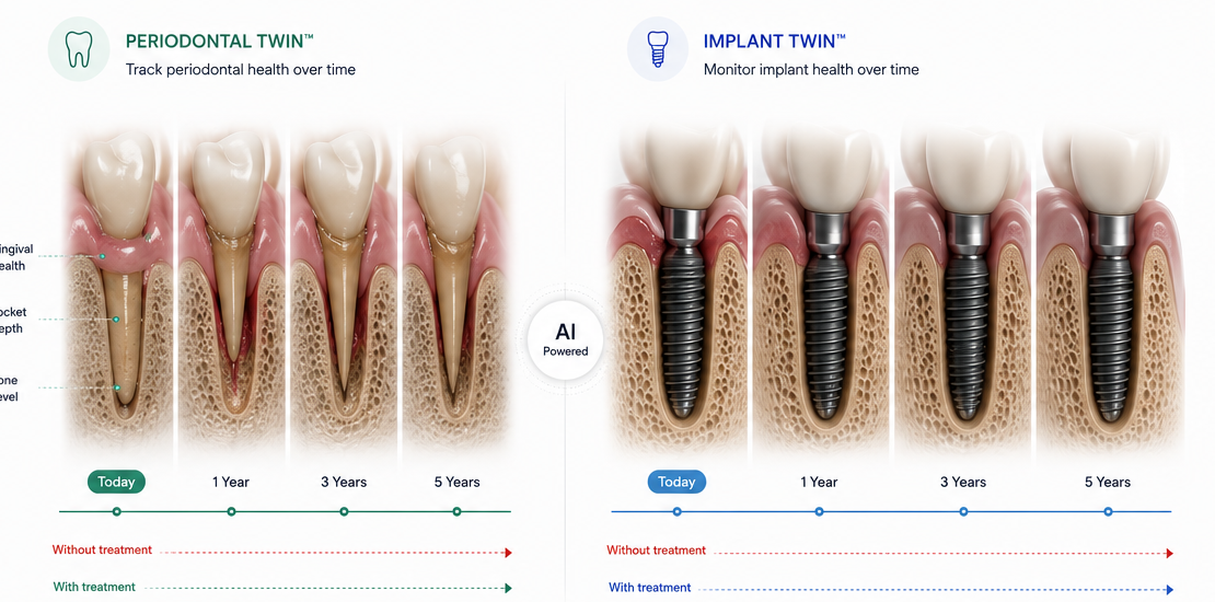 PerioSense Periodontal & Implant Twin Timelines