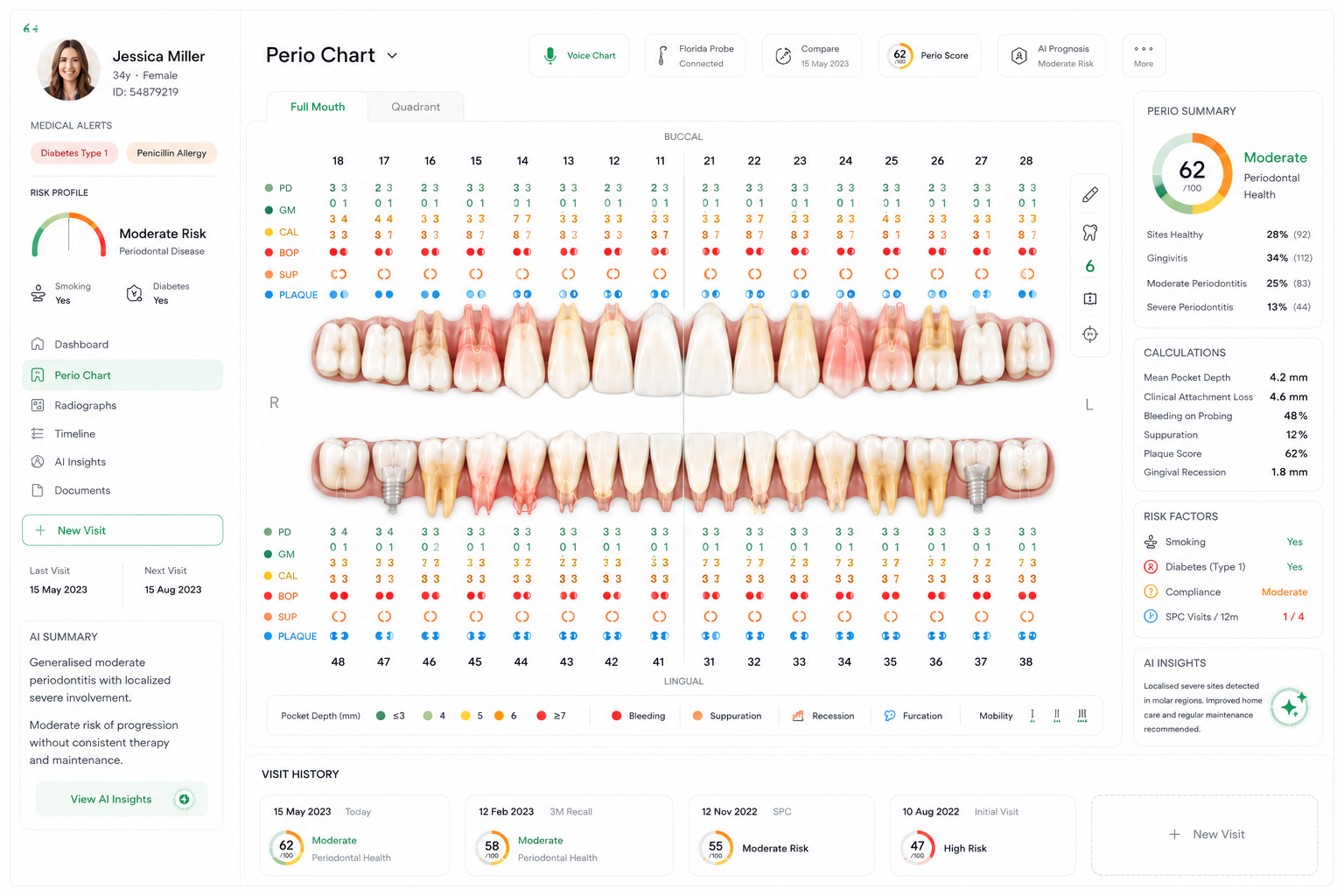 Modern periodontal chart showing full mouth assessment with pocket depths, bleeding, recession and mobility indicators